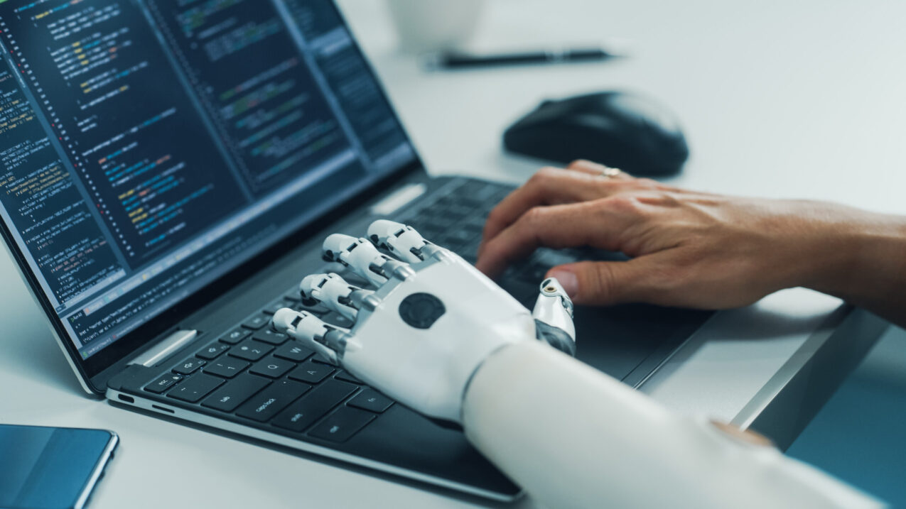 Close Up On Hands: Programmer With Disability Using Prosthetic Arm To Work On Laptop Computer. Specialist Swift And Natural Use Of Myoelectric Bionic Hand To Type Code For Software